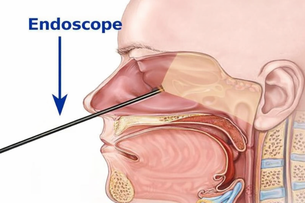 Skull Base Surgery