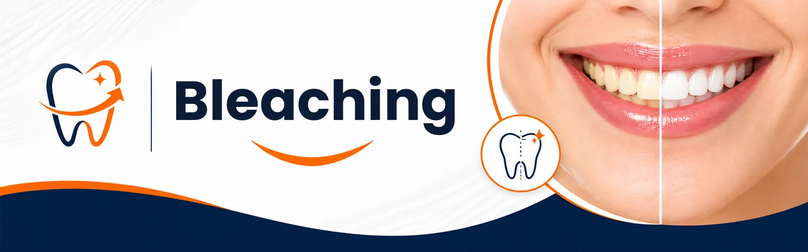 Bleaching