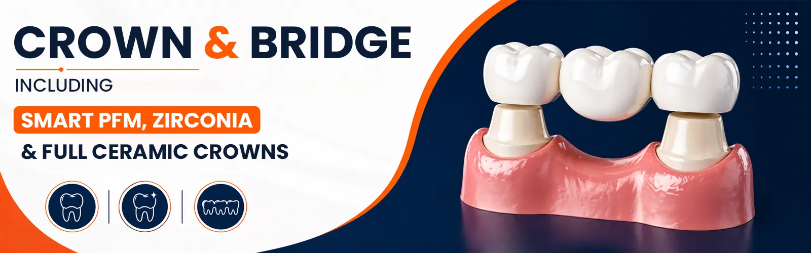 Crown & Bridge