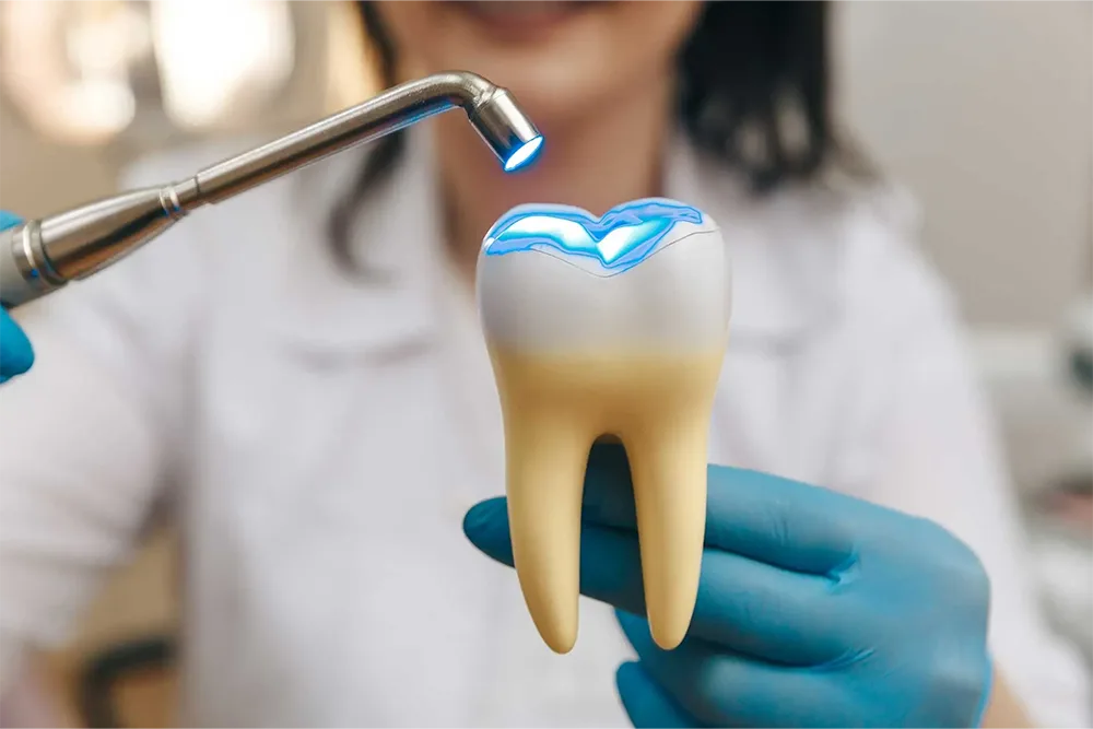 Fillings and Conservative Dentistry