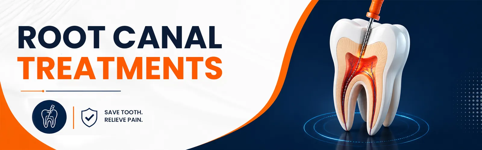 Root canal treatments