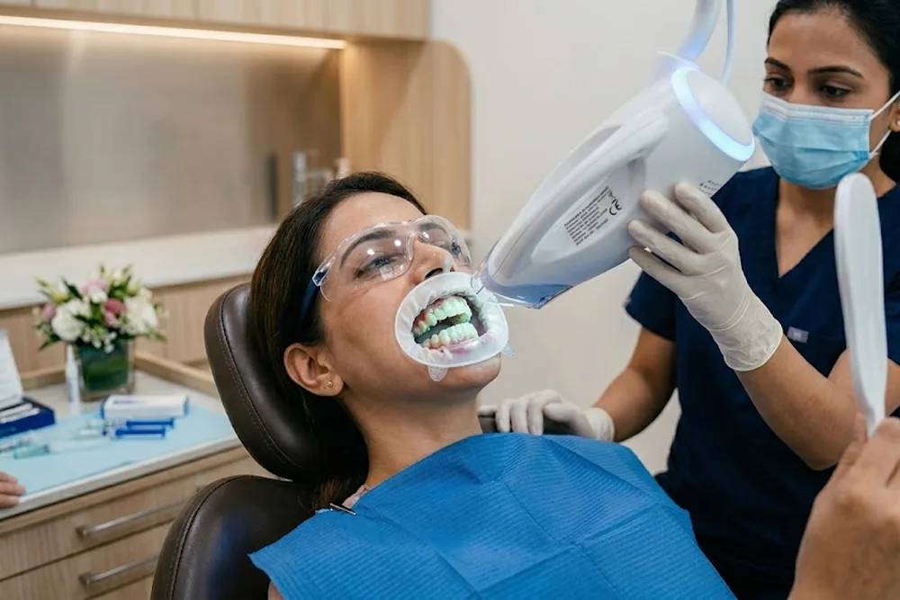 Teeth Bleaching
