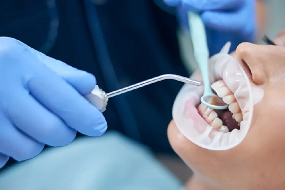 dental implants