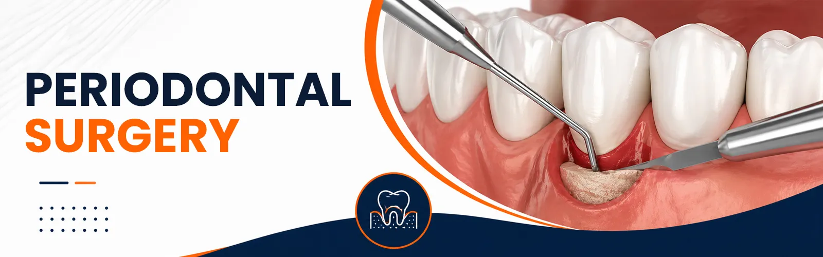 periodontal surgery
