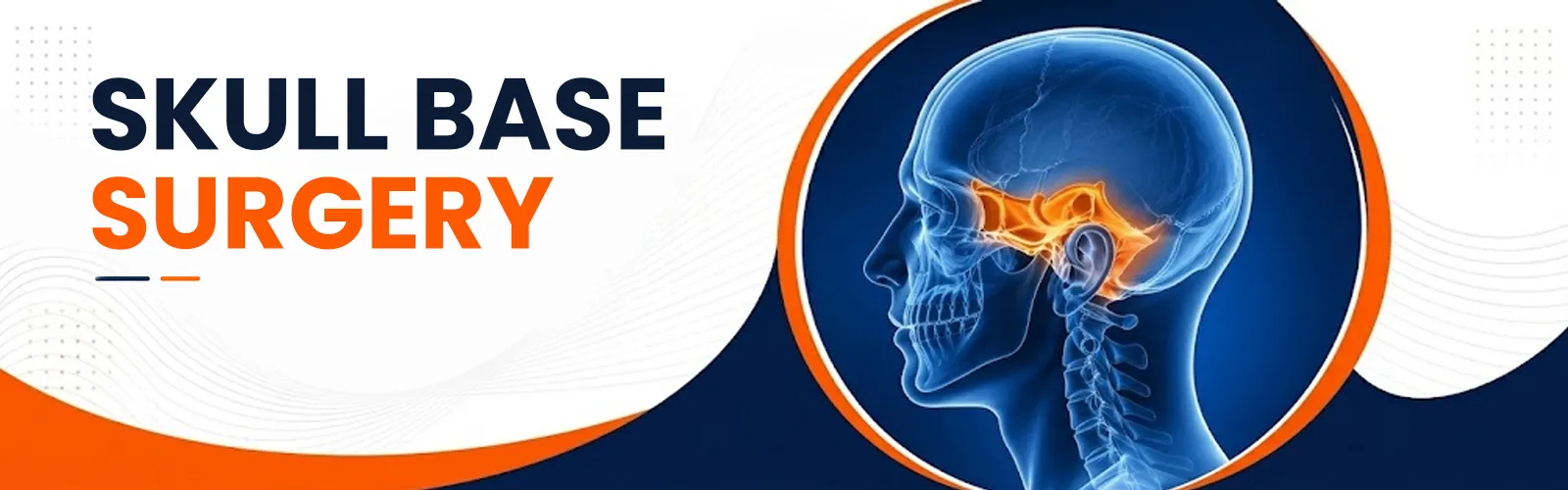 skull base surgery